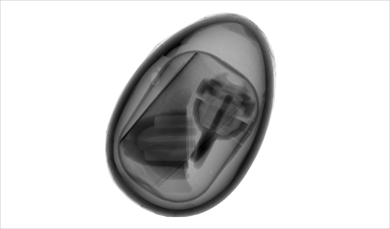 Secrets revealed – here the X-ray image of a chocolate egg with toy