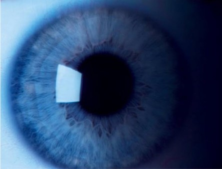 Sensor technology